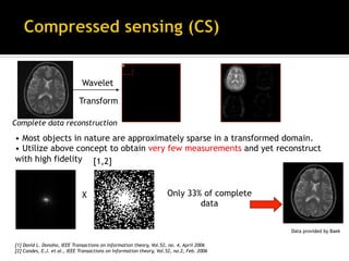 Introduction to compressed sensing MRI | PDF