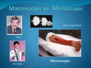 Tom
Scott Baio
Microscopic
Tom ’s Leg Wound
 