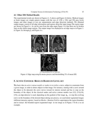 Computer Science & Information Technology (CS & IT) 45
4.1 Other DIS Method Results
The experimental results are shown in Figures (1, 3) above and Figure (4) below. Medical images
as brain images are simple pattern images with the size of {156 x 156} and 256 gray levels
images and other images to test our segmentation and edge detection methods. We obtained
output images consist of all edge information and regions about the input image.The region maps
are shown in Figure1-c. As can be seen from the edge maps Figure 1-d, that there are no broken
lines on the whole image regions. The output image was displayed as an edge map as in Figure 1-
d, Figure 3(e through g); and Figure 4-c.
(b) After K-means process.(a) Original image.
(c) Using threshold 25% of mean DIS.
Figure 4. Edge map using K-means process and thresholding 5% of mean DIS.
5. ACTIVE CONTOUR RESULTS BASED ON LEVEL SET
The basic idea in active contour models or snakes is to evolve a curve, subject to constraints from
a given image, in order to detect objects in that image. For instance, starting with a curve around
the object to be detected, the curve moves toward its interior normal and has to stop on the
boundary of the object. In the classical snakes and active contour models (see [12], [13],[14],
[15]), an edge-detector is used, depending on the gradient of the image 0u , to stop the evolving
curve on the boundary of the desired object.during our process, we used initial segmented images
(different intensity regions) based on Markov Random Field to superimpose the region boundary
and to extract the bounded region (segmented map) in our image as in Figure. 5 (b & c) as an
example.
 