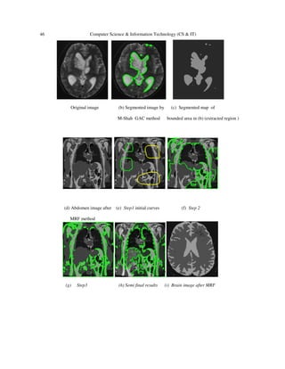 46 Computer Science & Information Technology (CS & IT)
Original image (b) Segmented image by (c) Segmented map of
M-Shah GAC method bounded area in (b) (extracted region )
(d) Abdomen image after (e) Step1 initial curves (f) Step 2
MRF method
(g) Step3 (h) Semi final results (i) Brain image after MRF
 