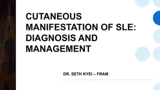 CUTANEOUS
MANIFESTATION OF SLE:
DIAGNOSIS AND
MANAGEMENT
DR. SETH KYEI – FRAM
 