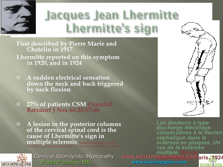 cervical arthritis cervical spondylotic myelopathy cervical steno cervical spondylosis with myelopathy