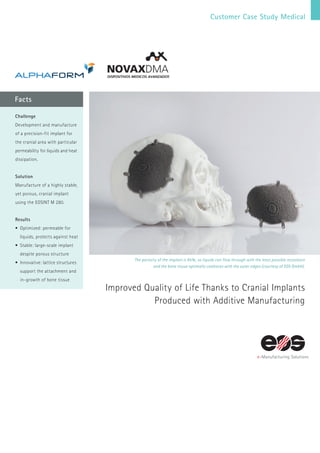 Customer Case Study Medical
Facts
The porosity of the implant is 95%, so liquids can flow through with the least possible resistance
and the bone tissue optimally coalesces with the outer edges (courtesy of EOS GmbH).
Improved Quality of Life Thanks to Cranial Implants
Produced with Additive Manufacturing
Challenge
Development and manufacture
of a precision-fit implant for
the cranial area with particular
permeability for liquids and heat
dissipation.
Solution
Manufacture of a highly stable,
yet porous, cranial implant
using the EOSINT M 280.
Results
•	Optimized: permeable for
liquids, protects against heat
•	Stable: large-scale implant
despite porous structure
•	Innovative: lattice structures
support the attachment and
in-growth of bone tissue
 