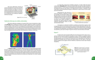 200 201
Figura 25.9. Horno microondas.
Radiación infrarroja, luz visible y ultravioleta
Otra de las radiaciones señaladas en el espectro EM, es la que corresponde a la radia-
ción infrarroja. Ésta es emitida por los átomos de cuerpos calientes, los cuales se encuentran
en una constante e intensa vibración. El calor que sientes cuando te acercas a un metal incan-
descente se debe en gran parte a los rayos infrarrojos que emite debido a su alta temperatura,
y que son absorbidos por tu cuerpo. Este proceso de transmisión de energía es lo que se cono-
ce como radiación térmica, que es aprovechada para cocinar, calentar los ambientes en lugares
fríos, la termografía (técnica que permite medir temperatura a distancia), entre otros.
Figura 25.10. Posibles efectos de la radiación UV
natural y artificial sobre la piel humana.
La radiación visible, la constituyen ondas que están en el rango de frecuencias desde
los 4.6.1014
Hz hasta aproximadamente 6.7.1014
Hz. Este rango tan estrecho de radiación tiene
la particularidad de estimular la visión humana, de ahí su nombre. Por eso, se han construido
instrumentos cada día más precisos para captar y poder estudiar las otras radiaciones, que por
su frecuencia no podemos ver. Dentro de la luz visible, las frecuencias menores nos dan el color
rojo, y al aumentar la frecuencia tendremos las ondas que corresponden a los colores naranja,
amarillo y violeta.
Las ondas EM con frecuencias inmediatas superiores a la región visible del espectro
se denominan ultravioleta, UV. Si observas el espectro EM, verás que esta región alcanza fre-
cuencias de hasta 1018
Hz, las cuales son emitidas por átomos excitados, como por ejemplo, en
las lámparas de mercurio. Estas ondas no son visibles para los humanos. La radiación UV que
incide sobre la Tierra proveniente del espacio es filtrada por la capa de ozono, de ahí la impor-
tancia de mantenerla.
Rayos X
Si observas de nuevo el espectro EM verás que las frecuencias de los rayos X son su-
periores a la frecuencia de la radiación ultravioleta. Los rayos X debido a su pequeña longitud
de onda (10-2
nm y 100
nm) tienen la propiedad de atravesar, con cierta facilidad, sustancias
de baja densidad como los músculos de una persona y de ser absorbidos por materiales de
densidad más elevada como los huesos del cuerpo humano. Por esta razón, se usan para
obtener imágenes de los órganos internos mediante la impresión de ciertos tipos de placas
fotográficas.
Otra de las aplicaciones comunes de
este tipo de radiación es su uso en los conocidos
hornos microondas. En la figura 25.9 tienes un
esquema de este tipo de equipo. Las microon-
das son absorbidas por los alimentos aumentan-
do la temperatura de los mismos, por aumento
en las vibraciones de la moléculas, fundamen-
talmente las de agua.
Seguramente has oído mencionar o
incluso has utilizado, la radiación UV emitida
por bombillos de bronceado artificial. Estas
lámparas emiten una luz de una longitud de
onda aproximada a UV-B (280-315 nm) y UV-A
(315-400 nm). El bronceado, considerado en
esta época como carácter de belleza, es un
mecanismo de reacción natural de nuestro
organismo, fotoprotección, frente a la radia-
ción ultravioleta (estrés).
Si te expones a la radiación UV artificial, es posible que sufras efectos negativos sobre
tu organismo. Entre los más conocidos tenemos: cáncer de la piel y daño grave en los ojos, reac-
ciones indeseables en la piel como alergias y quemaduras, e incluso afectar al feto si la expuesta
a la radiación está embarazada. Como puedes ver, la exposición a este tipo de radiación puede
ser perjudicial, ¿vale la pena arriesgar el organismo sólo por verte bronceada o bronceado?
Figura 25.11. Un tubo de rayos X. Los electrones
emitidos por el cátodo se aceleran hacia el ánodo,
donde colisionan con el material que lo conforma
(molibdeno…), cuyos átomos se excitan y emiten
radiación EM, para ciertas condiciones tendrán
mayor intensidad los Rayos X.
 