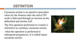 DEFINITION
• Caesarean section is an operative procedure
where by the foetuses after the end of 28th
week is delivered through an incision on the
abdominal and uterine wall.
• The first operation performed on woman is
referred to as a primary caesarean section.
• when the operation is performed in
subsequent pregnancies. It is called repeat
caesarean section
 
