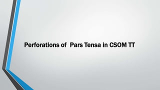 Perforations of Pars Tensa in CSOM TT
 