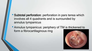 •Subtotal perforation: perforation in pars tensa which
involves all 4 quadrants and is surrounded by
annulus tympanicus
•Annulus tympanicus: periphery of TM is thickened to
form a fibrocartilaginous ring
 