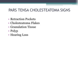 PARS TENSA CHOLESTEATOMA SIGNS
• Retraction Pockets
• Cholesteatoma Flakes
• Granulation Tissue
• Polyp
• Hearing Loss
 