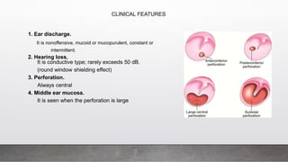 CLINICAL FEATURES
1. Ear discharge.
It is nonoffensive, mucoid or mucopurulent, constant or
intermittent.
2. Hearing loss.
It is conductive type; rarely exceeds 50 dB.
(round window shielding effect)
3. Perforation.
Always central
4. Middle ear mucosa.
It is seen when the perforation is large
 