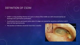Cpsom CSOM atticoantral.pptx