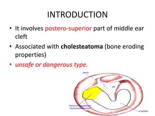 INTRODUCTION
• It involves postero-superior part of middle ear
cleft
• Associated with cholesteatoma (bone eroding
properties)
• unsafe or dangerous type.
 