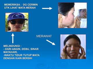 MEMERIKSA : DG CERMIN 
UTK LIHAT MATA MERAH 
MERAWAT 
MELINDUNGI : 
- DARI ANGIN, DEBU, SINAR 
MATAHARI, 
-WAKTU TIDUR TUTUP MATA 
DENGAN KAIN BERSIH 
 