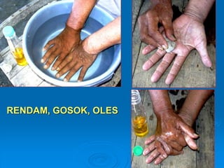 RENDAM, GOSOK, OLES 
 