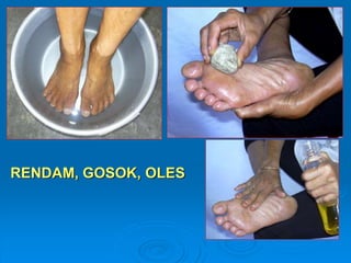 RENDAM, GOSOK, OLES 
 
