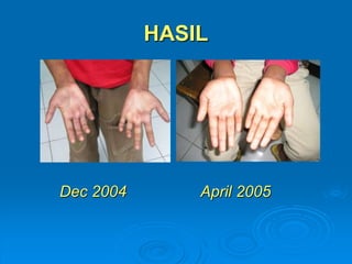 HASIL 
Dec 2004 April 2005 
 