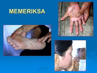 MEMERIKSA 
 