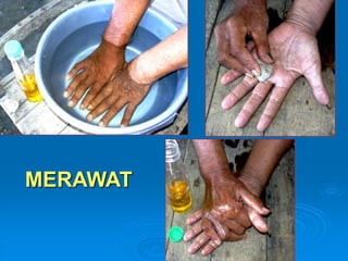 ‘ 
MERAWAT 
 