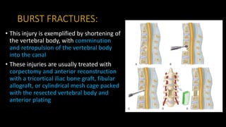Cervical spine injuries | PPTX