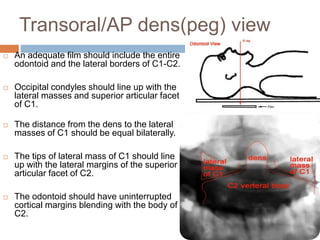 Transoral/AP dens(peg) view
 An adequate film should include the entire
odontoid and the lateral borders of C1-C2.
 Occipital condyles should line up with the
lateral masses and superior articular facet
of C1.
 The distance from the dens to the lateral
masses of C1 should be equal bilaterally.
 The tips of lateral mass of C1 should line
up with the lateral margins of the superior
articular facet of C2.
 The odontoid should have uninterrupted
cortical margins blending with the body of
C2.
 