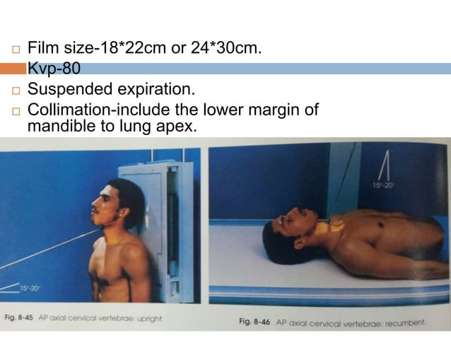 Cd Spine Example C spine positioning | PPTX