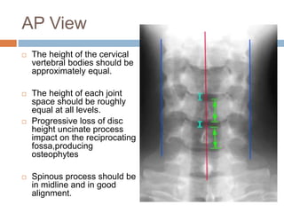 C spine positioning | PPTX