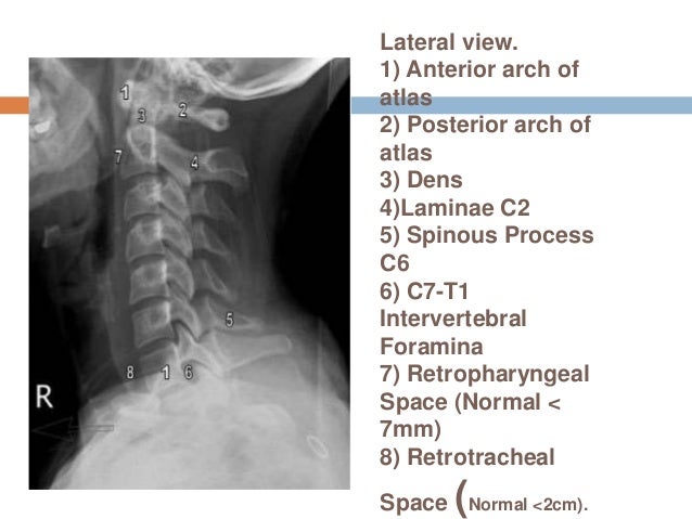 C spine positioning
