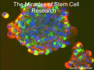 The Miracles of Stem Cell Research  By, Jacob Schechter 