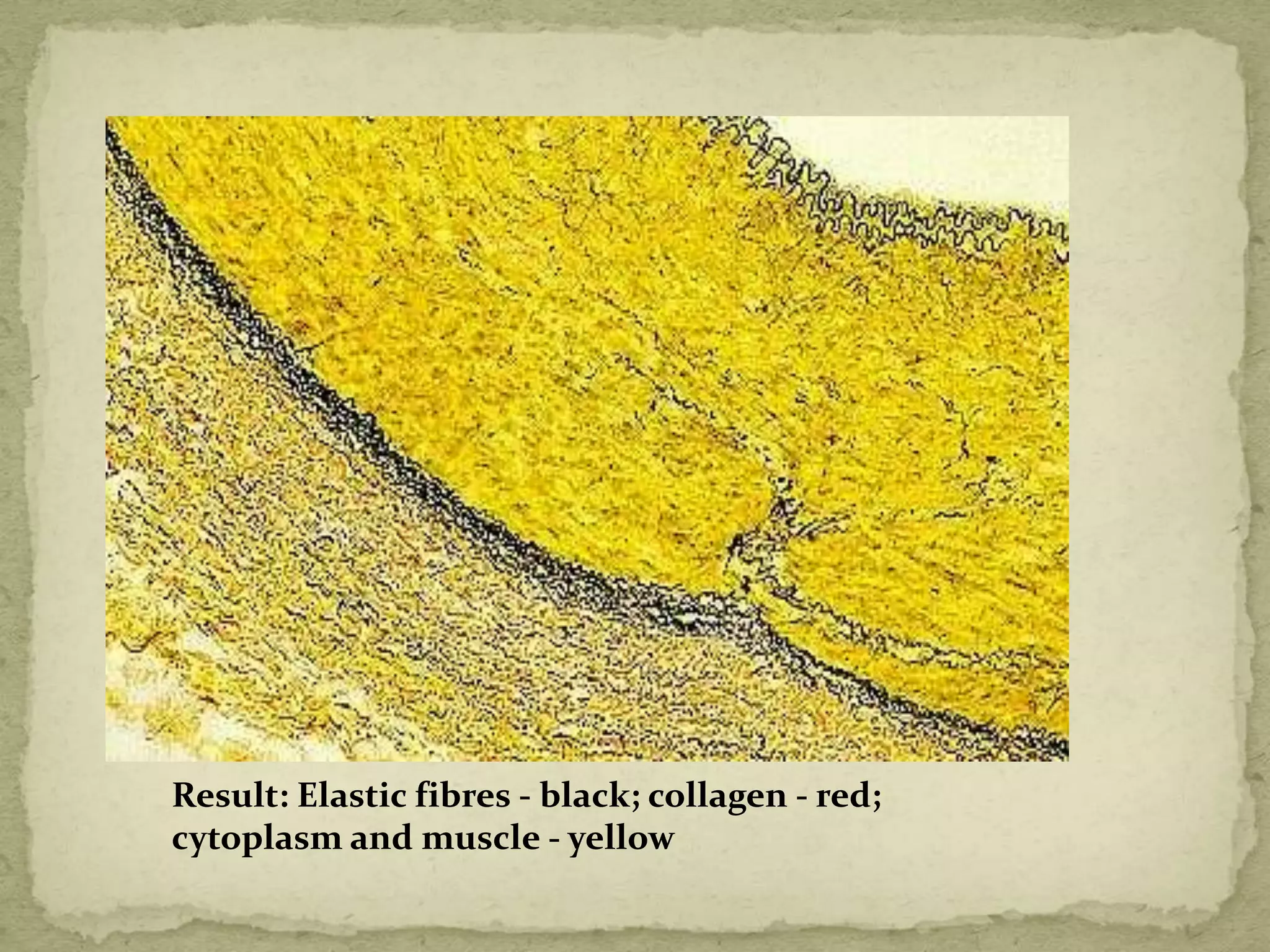 Result: Elastic fibres - black; collagen - red;
cytoplasm and muscle - yellow
 