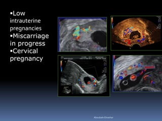Low
intrauterine
pregnancies
Miscarriage
in progress
Cervical
pregnancy
AboubakrElnashar
 