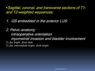 Sagittal, coronal, and transverse sections of T1-
and T2-weighted sequences:
1. GS embedded in the anterior LUS
2. Pelvic anatomy
intraoperative orientation
myometrial invasion and bladder involvement
T1: fat: bright . fluid: dark
T2: fat: intermediate-bright. fluid: bright
AboubakrElnashar
 