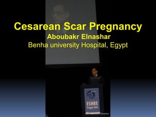 Cesarean Scar Pregnancy
Aboubakr Elnashar
Benha university Hospital, Egypt
AboubakrElnashar
 