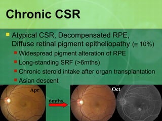 Chronic CSR
 Atypical CSR, Decompensated RPE,
Diffuse retinal pigment epitheliopathy (≅ 10%)
 Widespread pigment alteration of RPE
 Long-standing SRF (>6mths)
 Chronic steroid intake after organ transplantation
 Asian descent
6mths
Apr Oct
 