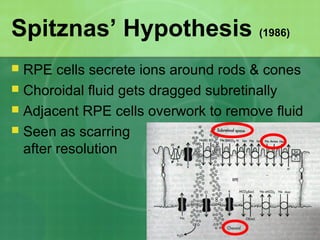 Spitznas’ Hypothesis (1986)
 RPE cells secrete ions around rods & cones
 Choroidal fluid gets dragged subretinally
 Adjacent RPE cells overwork to remove fluid
 Seen as scarring
after resolution
 