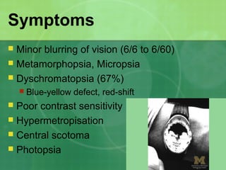 Symptoms
 Minor blurring of vision (6/6 to 6/60)
 Metamorphopsia, Micropsia
 Dyschromatopsia (67%)
 Blue-yellow defect, red-shift
 Poor contrast sensitivity
 Hypermetropisation
 Central scotoma
 Photopsia
 