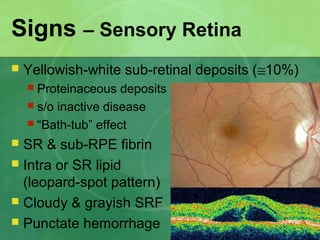 Signs – Sensory Retina
 Yellowish-white sub-retinal deposits (≅10%)
 Proteinaceous deposits
 s/o inactive disease
 “Bath-tub” effect
 SR & sub-RPE fibrin
 Intra or SR lipid
(leopard-spot pattern)
 Cloudy & grayish SRF
 Punctate hemorrhage
 