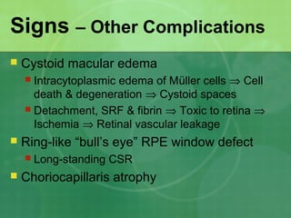 Signs – Other Complications
 Cystoid macular edema
 Intracytoplasmic edema of Müller cells ⇒ Cell
death & degeneration ⇒ Cystoid spaces
 Detachment, SRF & fibrin ⇒ Toxic to retina ⇒
Ischemia ⇒ Retinal vascular leakage
 Ring-like “bull’s eye” RPE window defect
 Long-standing CSR
 Choriocapillaris atrophy
 