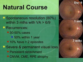 Natural Course
 Spontaneous resolution (80%)
within 3 mths with VA > 6/9
 Recurrences:
 30-50% cases
 50% within 1 year
 10% have > 2 episodes
 Severe & permanent visual loss (10%):
 Persistent detachment
 CNVM, CME, RPE atrophy
Day 0
1 mth
3 mths
 