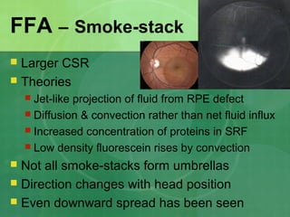 FFA – Smoke-stack
 Larger CSR
 Theories
 Jet-like projection of fluid from RPE defect
 Diffusion & convection rather than net fluid influx
 Increased concentration of proteins in SRF
 Low density fluorescein rises by convection
 Not all smoke-stacks form umbrellas
 Direction changes with head position
 Even downward spread has been seen
 