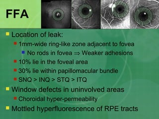 FFA
 Location of leak:
 1mm-wide ring-like zone adjacent to fovea
 No rods in fovea ⇒ Weaker adhesions
 10% lie in the foveal area
 30% lie within papillomacular bundle
 SNQ > INQ > STQ > ITQ
 Window defects in uninvolved areas
 Choroidal hyper-permeability
 Mottled hyperfluorescence of RPE tracts
 