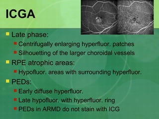 ICGA
 Late phase:
 Centrifugally enlarging hyperfluor. patches
 Silhouetting of the larger choroidal vessels
 RPE atrophic areas:
 Hypofluor. areas with surrounding hyperfluor.
 PEDs:
 Early diffuse hyperfluor.
 Late hypofluor. with hyperfluor. ring
 PEDs in ARMD do not stain with ICG
 