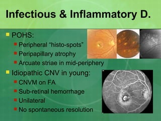 Infectious & Inflammatory D.
 POHS:
 Peripheral “histo-spots”
 Peripapillary atrophy
 Arcuate striae in mid-periphery
 Idiopathic CNV in young:
 CNVM on FA
 Sub-retinal hemorrhage
 Unilateral
 No spontaneous resolution
 