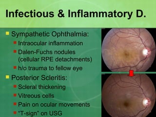 Infectious & Inflammatory D.
 Sympathetic Ophthalmia:
 Intraocular inflammation
 Dalen-Fuchs nodules
(cellular RPE detachments)
 h/o trauma to fellow eye
 Posterior Scleritis:
 Scleral thickening
 Vitreous cells
 Pain on ocular movements
 “T-sign” on USG
 