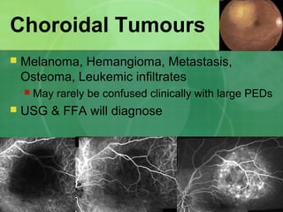 Choroidal Tumours
 Melanoma, Hemangioma, Metastasis,
Osteoma, Leukemic infiltrates
 May rarely be confused clinically with large PEDs
 USG & FFA will diagnose
 