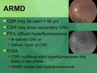 ARMD
 CSR may be seen > 50 yrs
 CSR may show secondary CNV
 FFA: diffuse hyperfluorescence
 Ill-defined CNV or
 Diffuse ‘ooze’ of CSR
 ICGA:
 CSR: multifocal early hyperfluorescence that
fades in late phase
 ARMD: shows late hyperfluorescence
 