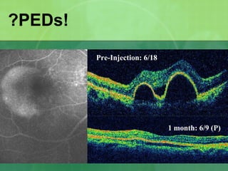 1 month: 6/9 (P)
Pre-Injection: 6/18
?PEDs!
 