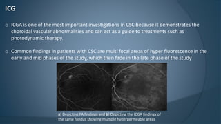 ICG
o ICGA is one of the most important investigations in CSC because it demonstrates the
choroidal vascular abnormalities and can act as a guide to treatments such as
photodynamic therapy.
o Common findings in patients with CSC are multi focal areas of hyper fluorescence in the
early and mid phases of the study, which then fade in the late phase of the study
a) Depicting FA findings and b) Depicting the ICGA findings of
the same fundus showing multiple hyperpermeable areas
 