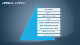 Macular hole
Optic pit
Malignant Hypertension
AMD
Idiopathic uveal effusion syndrome
Ocular histoplasmosis syndrome
Vogt-Koyanagi-Harada’s disease
Pathological myopia
Choroidal tumors
Differential Diagnosis
 