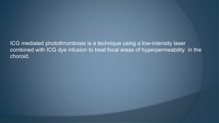 ICG mediated photothrombosis is a technique using a low-intensity laser
combined with ICG dye infusion to treat focal areas of hyperpermeability in the
choroid.
 