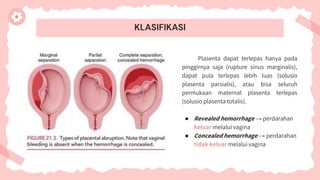 KLASIFIKASI
Plasenta dapat terlepas hanya pada
pinggirnya saja (rupture sinus marginalis),
dapat pula terlepas lebih luas (solusio
plasenta parsialis), atau bisa seluruh
permukaan maternal plasenta terlepas
(solusio plasenta totalis).
● Revealed hemorrhage → perdarahan
keluar melalui vagina
● Concealed hemorrhage → perdarahan
tidak keluar melalui vagina
 