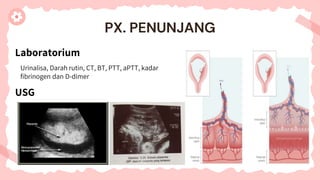Laboratorium
PX. PENUNJANG
USG
Urinalisa, Darah rutin, CT, BT, PTT, aPTT, kadar
fibrinogen dan D-dimer
 